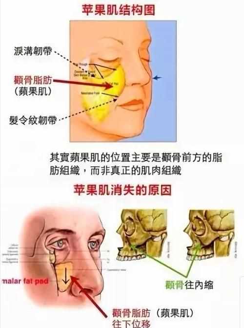 颧骨是指五官的哪个地方图片