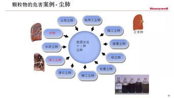 放射安全防护知识ppt