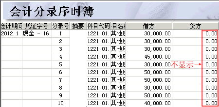 放在,会计科目,社保费