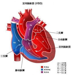 心脏病的诊断方法有哪些呢