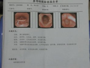 喉咙检查方法有哪些