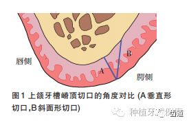 组织切开的方法有哪些