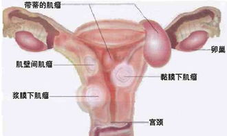 缩阴方法有哪些虹桥医院网址