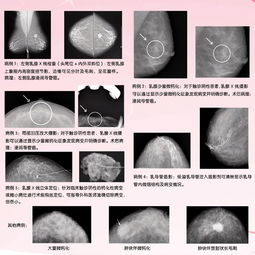 深部触诊法包括哪些简述其触诊方法及临床意义