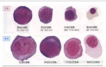 有哪些方法可以辨认血细胞