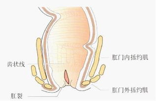 肛裂有效治疗方法有哪些