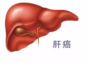 肝肿瘤有哪些治疗方法