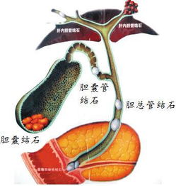 对胆的检查有哪些方法