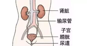 尿路感染做哪些治疗方法