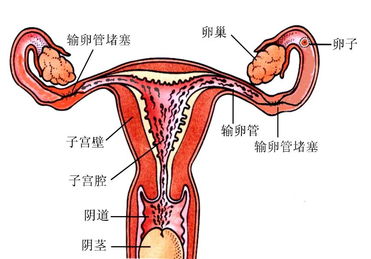 治输卵管不通最佳方法有哪些方法