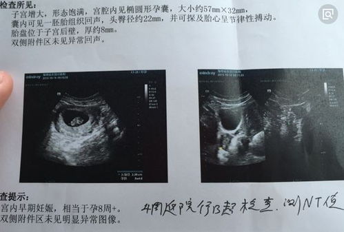 注意事项,怀孕