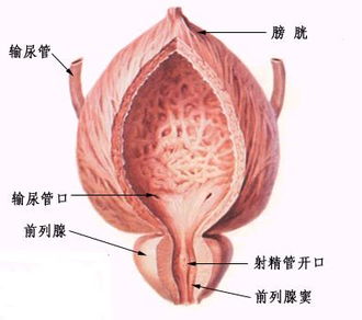 前列腺结石注意什么,前列腺结石的注意事项,前列腺结石饮食注意事项