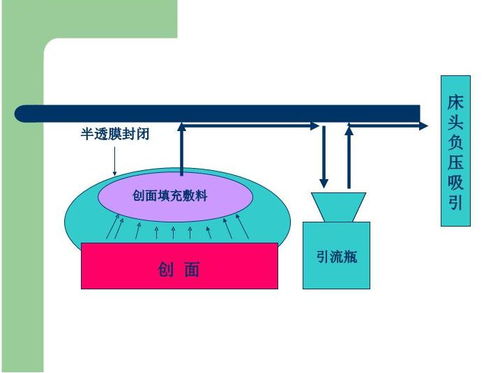 vsd负压吸引的注意事项