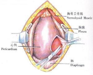 心包穿刺术后注意事项,心包穿刺术后护理注意事项,心包穿刺护理注意事项