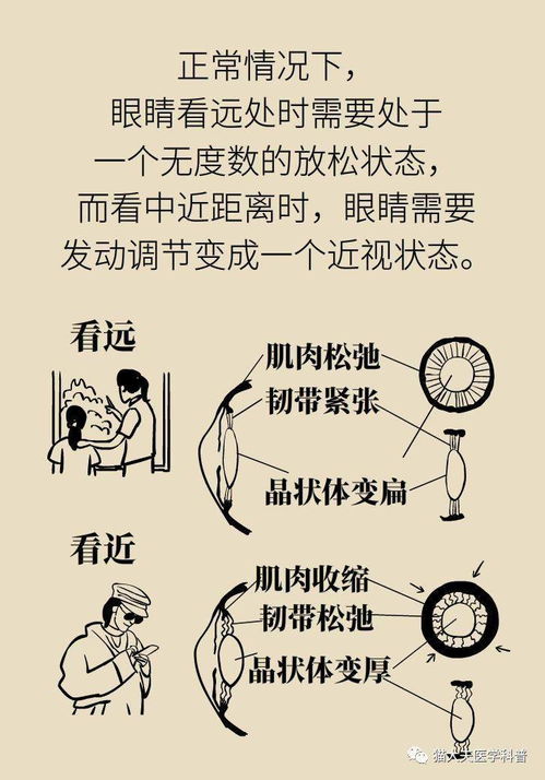 散瞳验光的危害及注意事项,散瞳验光的意义及注意事项,散瞳验光的目的及注意事项