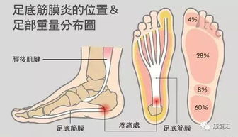 腰背肌筋膜炎注意事项