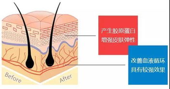 螺旋线,埋入,韩国,蛋白