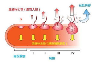 检查大便之前注意事项,婴儿检查大便常规注意事项,大便隐血检查注意事项