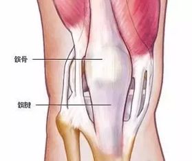 肌腱断裂修补注意事项