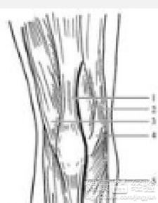 肌腱,断裂,修补,注意事项