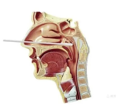 咽拭子采集注意事项,新型冠状病毒口咽拭子采集注意事项,核酸咽拭子采集注意事项