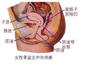 盆腔积液检查前注意事项,盆腔积液的注意事项,盆腔积液术后注意事项