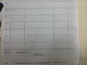 b受体阻滞剂应用注意事项