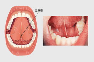 细带,注意事项,手术