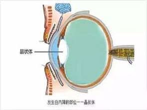 脖子做完手术后怎么注意事项