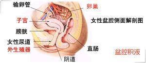 查盆腔积液前注意事项