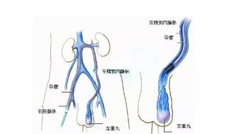 手术后,注意事项