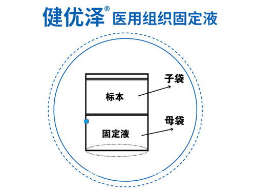 使用10甲醛固定液的注意事项