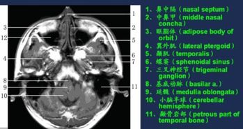 增强核磁共振注意事项