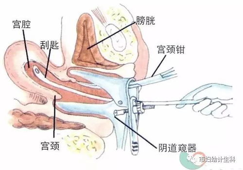 做无痛人流前需要注意什么,做无痛人流手术前需要注意什么,无痛人流手术前注意事项有哪些