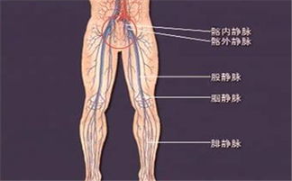 静脉血栓形成注意事项