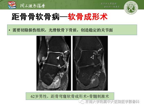 做ct后饮食注意事项