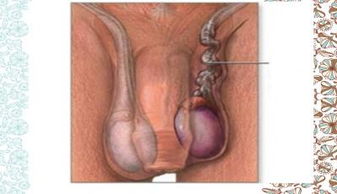 睾丸切除术前注意事项
