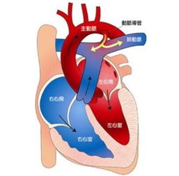 婴儿肺动脉高压应注意事项