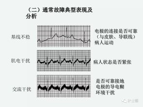 上心电监护的注意事项