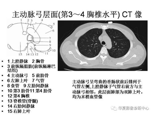 ct读片基础知识