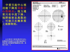 光学检测类基础知识