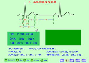 最新章节心电图基础知识1