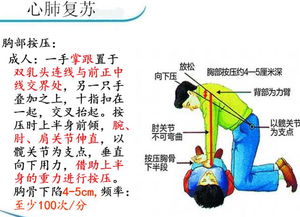 院前急救基础知识