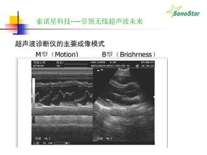 学b超基础知识