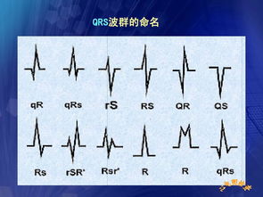 心电图,基础知识,护理,教学